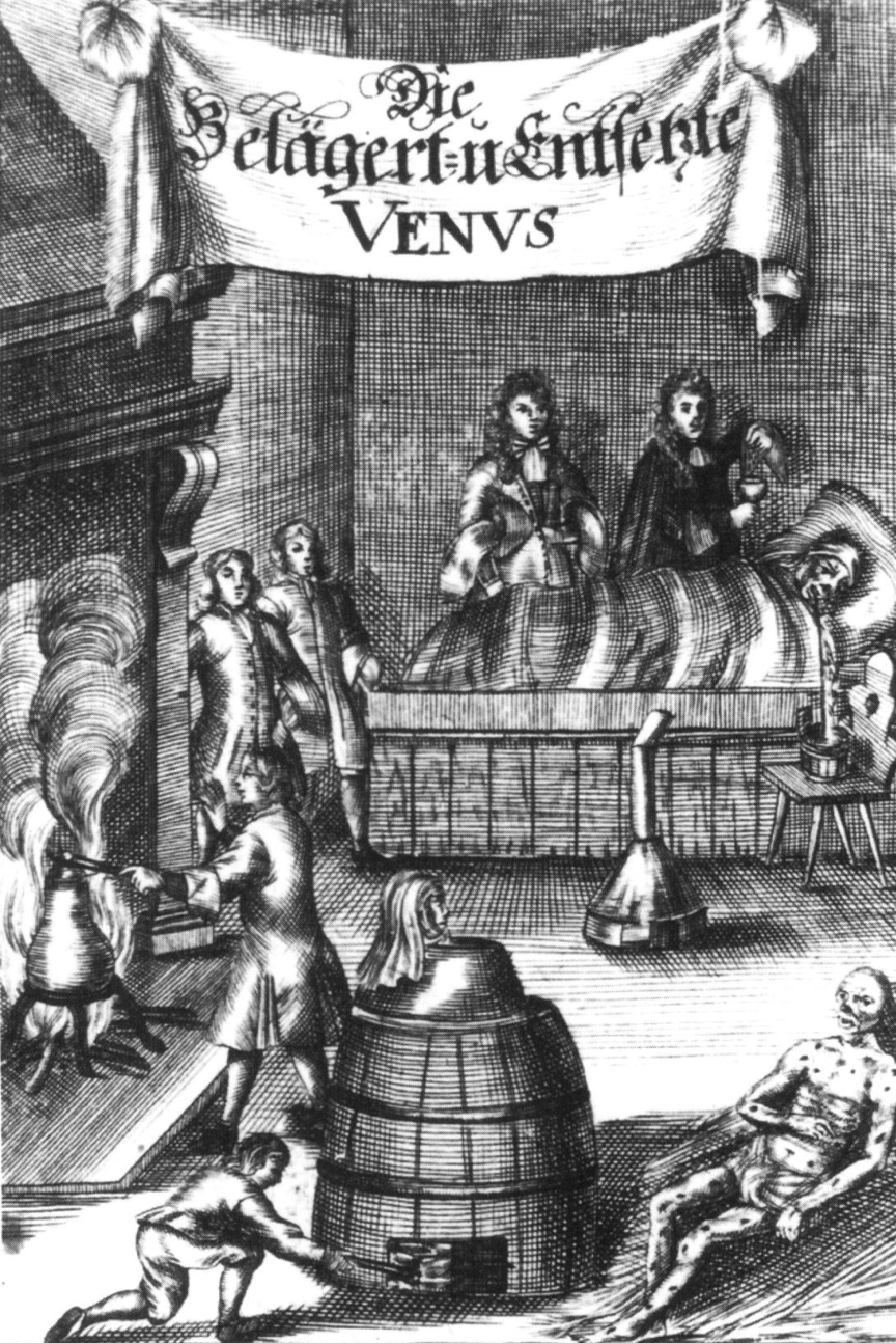 Szifilisz kezelésének módozatai. (Steven Blankaart: Die belägert- und entsetzte Venus. Augsburg, 1710)
